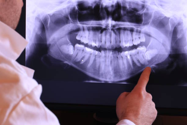 Best Emergency Treatment for Dental Infections or Abscesses in Lake Camelot, IL