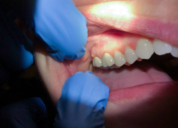 Best Emergency TMJ Treatment in Lake Camelot, IL