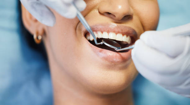 Best Emergency Denture Repair in Lake Camelot, IL